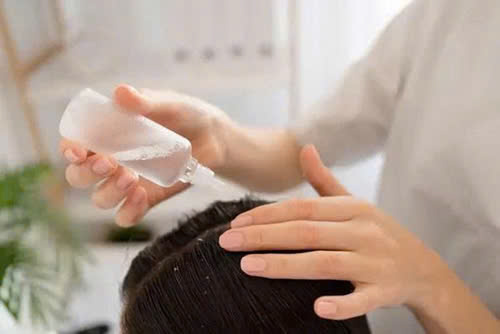 Gàu là gì và cách điều trị gàu hiệu quả