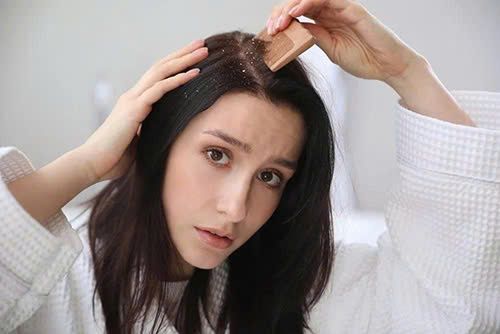 Tìm hiểu Gàu là gì
